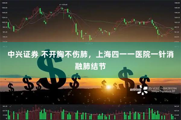 中兴证券 不开胸不伤肺，上海四一一医院一针消融肺结节